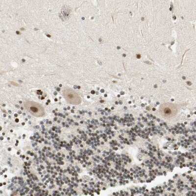 Immunohistochemistry-Paraffin: Cdk7 Antibody [NBP1-86666] - Staining of human cerebellum shows moderate nuclear positivity in Purkinje cells.