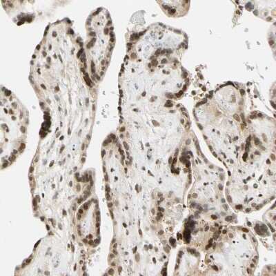 Immunohistochemistry-Paraffin: Cdk7 Antibody [NBP1-86666] - Staining of human placenta shows moderate to strong nuclear positivity in trophoblastic cells.