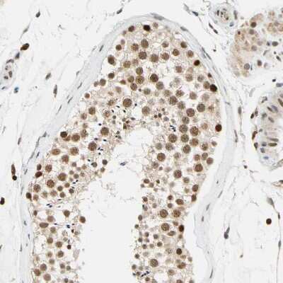 Immunohistochemistry-Paraffin: Cdk7 Antibody [NBP1-86666] - Staining of human testis shows strong nuclear positivity in cells in seminiferous ducts.