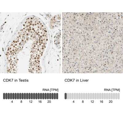 <b>Orthogonal Strategies Validation. </b>Immunohistochemistry-Paraffin: Cdk7 Antibody [NBP1-86666] - Staining in human testis and liver tissues using NBP1-86666 antibody. Corresponding CDK7 RNA-seq data are presented for the same tissues.