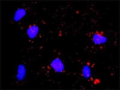 Proximity Ligation Assay: Cdk7 Antibody [H00001022-D01P] - Analysis of protein-protein interactions between CDK7 and E2F1. HeLa cells were stained with anti-CDK7 rabbit purified polyclonal 1:1200 and anti-E2F1 mouse monoclonal antibody 1:50. Each red dot represents the detection of protein-protein interaction complex, and nuclei were counterstained with DAPI (blue).