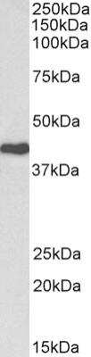 Western Blot: Cdk7 Antibody [NBP2-42500] - Analysis of Jurkat lysate (35 ug protein in RIPA buffer). Primary incubation was 1 hour. Detected by chemiluminescence.