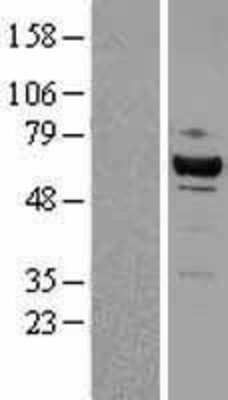 Western Blot: Cdk8 Overexpression Lysate (Adult Normal) [NBL1-09046] Left-Empty vector transfected control cell lysate (HEK293 cell lysate); Right -Over-expression Lysate for Cdk8.