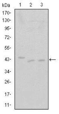 Western Blot: Cdk9 Antibody (1B5D10) [NBP2-37600] - Western blot analysis using CDK9 mouse mAb against Jurkat (1), A431 (2) and HEK293 (3) cell lysate.