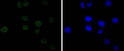 Immunocytochemistry/Immunofluorescence: Cdk9 Antibody (SD204-07) [NBP2-67811] - Staining Cdk9 in A549 cells (green). The nuclear counter stain is DAPI (blue). Cells were fixed in paraformaldehyde, permeabilised with 0.25% Triton X-100/PBS.