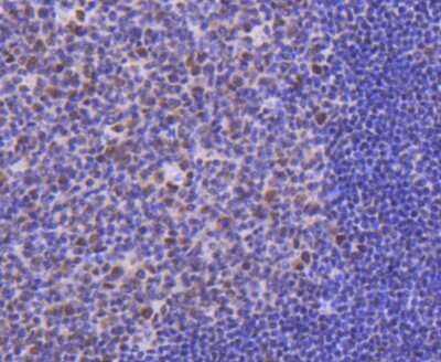 Immunohistochemistry-Paraffin: Cdk9 Antibody (SD204-07) [NBP2-67811] - Analysis of paraffin-embedded human tonsil tissue using anti-Cdk9 antibody. Counter stained with hematoxylin.