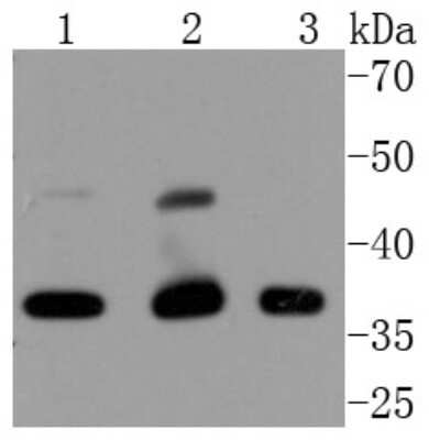 Western Blot: Cdk9 Antibody (SD204-07) [NBP2-67811] - Analysis of Cdk9 on different lysates using anti-Cdk9 antibody at 1:1,000 dilution. Positive control: Lane 1: HeLa Lane 2: Jurkat Lane 3: A431