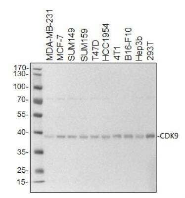 Western Blot: Cdk9 Antibody (SD204-07) [NBP2-67811] - MDA-MB-231, MCF-7, SUM149, SUM159, T47D, HCC1954, 4T1, B16-F10, Hep3b and 293T cells lysates (20 ug/lane). 10% SDS-PAGE. CDK9 (NB2-67811) primary antibody at 1:2000, 4C, overnight. Image submitted by a verified customer review.