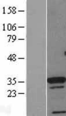 Western Blot: Cdx4 Overexpression Lysate (Adult Normal) [NBL1-09066] Left-Empty vector transfected control cell lysate (HEK293 cell lysate); Right -Over-expression Lysate for Cdx4.