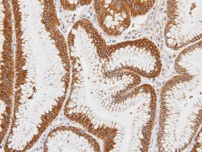 Immunohistochemistry-Paraffin: Centaurin alpha 1 Antibody [NBP1-31179] - Paraffin-embedded gastric tissue, using antibody at 1:100 dilution.