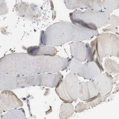 Immunohistochemistry-Paraffin: Centaurin alpha 1 Antibody [NBP1-88097] - Staining of human Skeletal muscle shows very weak cytoplasmic positivity in myocytes.