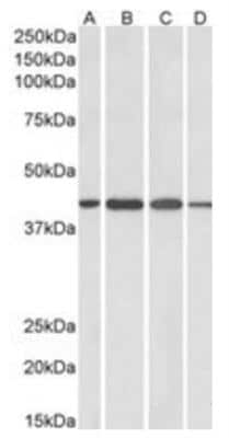 Western Blot: Centaurin alpha 1 Antibody [NB300-907] - Staining of Human Cerebellum (A), Mouse (B), Rat (C) and Pig (D) Brain lysates (35ug protein in RIPA buffer). Primary incubation was 1 hour. Detected by chemiluminescence.