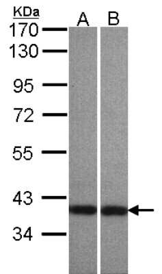 Western Blot: Centaurin alpha 1 Antibody [NBP1-31179] - Sample(30 ug of whole cell lysate)A: A431 B: HeLaS3 7. 5% SDS PAGE, antibody diluted at 1:500.