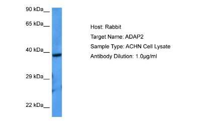 Western Blot: Centaurin alpha 2 Antibody [NBP2-86599] - Host: Rabbit. Target Name: ADAP2. Sample Tissue: ACHN Whole Cell lysates. Antibody Dilution: 1.0ug/ml