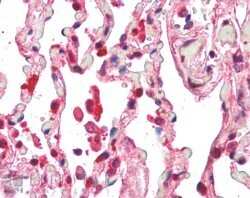 Immunohistochemistry-Paraffin: Centaurin beta 2 Antibody [NB100-1321] - (5ug/ml) staining of paraffin embedded Human Lung. Steamed antigen retrieval with citrate buffer pH 6, AP-staining.
