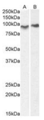Western Blot: Centaurin beta 2 Antibody [NB100-1321] - Staining of Mouse (A) and Rat (B) Lung lysate (35ug protein in RIPA buffer). Primary incubation was 1 hour. Detected by chemiluminescence.