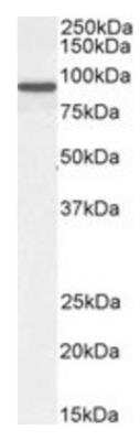 Western Blot: Centaurin beta 2 Antibody [NB100-1321] - Staining of NIH3T3 cell lysate (35ug protein in RIPA buffer). Primary incubation was 1 hour. Detected by chemiluminescence.