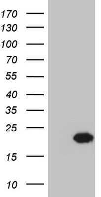 Western Blot: Centrin 1 Antibody (OTI1E1) - Azide and BSA Free [NBP2-70408] - Analysis of HEK293T cells were transfected with the pCMV6-ENTRY control (Left lane) or pCMV6-ENTRY Centrin 1.