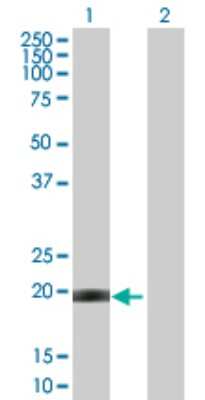 Western Blot: Centrin 1 Antibody [H00001068-B01P] - Analysis of CETN1 expression in transfected 293T cell line by CETN1 polyclonal antibody.  Lane 1: CETN1 transfected lysate(18.92 KDa). Lane 2: Non-transfected lysate.