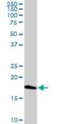 Western Blot: Centrin 1 Antibody [H00001068-D01P] - Analysis of CETN1 expression in mouse kidney.
