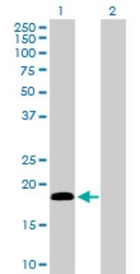 Western Blot: Centrin 1 Antibody [H00001068-D01P] - Analysis of CETN1 expression in transfected 293T cell line by CETN1 polyclonal antibody.Lane 1: CETN1 transfected lysate(19.60 KDa).Lane 2: Non-transfected lysate.