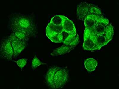 Immunocytochemistry/Immunofluorescence: Centrin 2 Antibody [NBP2-96991] - Immunofluorescence staining of Centrin 2 in MCF7 cells. Cells were fixed with 4% PFA, blocked with 10% serum, and incubated with rabbit anti- Centrin 2 polyclonal antibody (dilution ratio: 1:1000) at 4C overnight. Then cells were stained with the Alexa Fluor(R)488-conjugated Goat Anti-rabbit IgG Secondary antibody (green).Positive staining was localized to cytoplasm and nucleus.