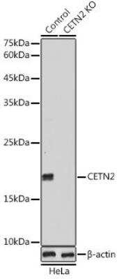 Western Blot Centrin 2 Antibody - Azide and BSA Free