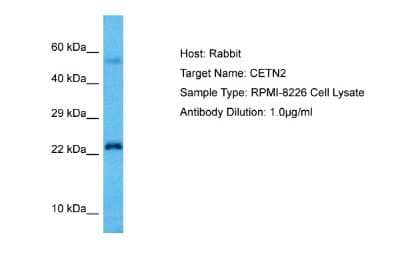 Western Blot: Centrin 2 Antibody [NBP2-86603] - Host: Rabbit. Target Name: CETN2. Sample Tissue: Human RPMI 8226 Whole Cell lysates. Antibody Dilution: 1ug/ml