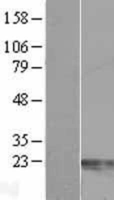 Western Blot Centrin 2 Overexpression Lysate