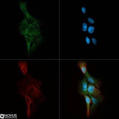 Immunocytochemistry/ Immunofluorescence Ceramide Kinase Antibody