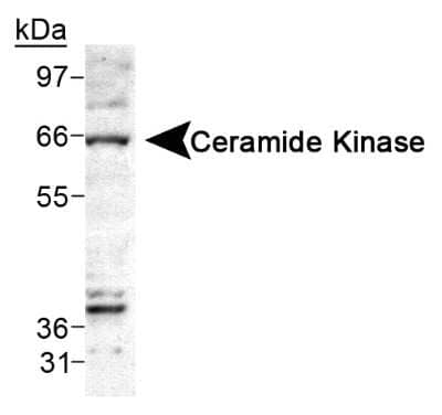 Western Blot Ceramide Kinase Antibody