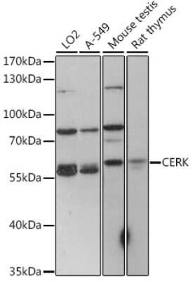 Western Blot Ceramide Kinase Antibody - Azide and BSA Free