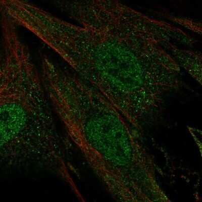 Immunocytochemistry/ Immunofluorescence Ceramide Kinase Like Antibody