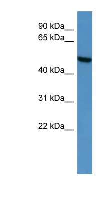 Western Blot Ceramide Kinase Like Antibody