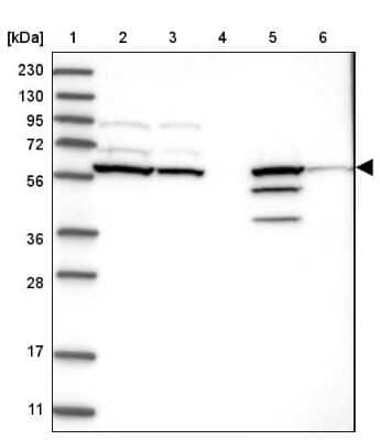 Western Blot Ceramide Kinase Like Antibody