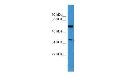 Western Blot: Ceramide Kinase Like Antibody [NBP2-87178] - WB Suggested Anti-CERKL Antibody Titration: 0.2-1 ug/ml. ELISA Titer: 1:312500. Positive Control: ACHN cell lysate