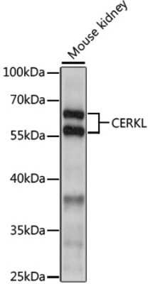 Western Blot: Ceramide Kinase Like Antibody [NBP2-92288] - Analysis of extracts of mouse kidney, using Ceramide Kinase Like at 1:1000 dilution.Secondary antibody: HRP Goat Anti-Rabbit IgG (H+L) at 1:10000 dilution.Lysates/proteins: 25ug per lane.Blocking buffer: 3% nonfat dry milk in TBST.Detection: ECL Basic Kit .Exposure time: 30s.