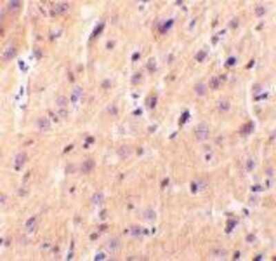 Immunohistochemistry-Paraffin: Cerebellin-1/Precerebellin Antibody [NBP1-77239] - Rat brain tissue using precerebellin antibody at 2 ug/ml.