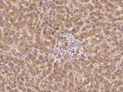 Immunohistochemistry-Paraffin: Ceruloplasmin Antibody [NBP3-05810] - Staining of human CP in human liver with rabbit polyclonal antibody at 1:100 dilution.