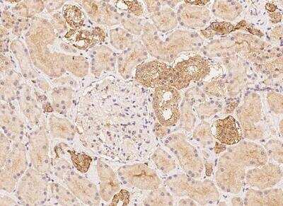 Immunohistochemistry-Paraffin: Ceruloplasmin Antibody [NBP3-05810] - Staining of human CP in human kidney with rabbit polyclonal antibody at 1:100 dilution.