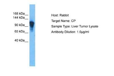 Western Blot: Ceruloplasmin Antibody [NBP2-82663] - Host: Rabbit. Target Name: CP. Sample Tissue: Human Liver Tumor. Antibody Dilution: 1.0ug/ml