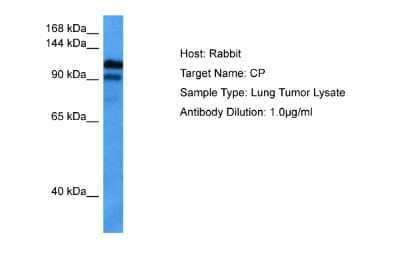 Western Blot: Ceruloplasmin Antibody [NBP2-82664] - Host: Rabbit. Target Name: CP. Sample Tissue: Human Lung Tumor lysates. Antibody Dilution: 1ug/ml