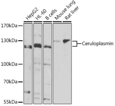 Western Blot: Ceruloplasmin Antibody [NBP2-92507] - Analysis of extracts of various cell lines, using Ceruloplasmin at 1:1000 dilution.Secondary antibody: HRP Goat Anti-Rabbit IgG (H+L) at 1:10000 dilution.Lysates/proteins: 25ug per lane.Blocking buffer: 3% nonfat dry milk in TBST.Detection: ECL Basic Kit .Exposure time: 90s.