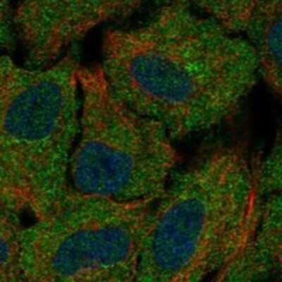 Immunocytochemistry/Immunofluorescence: ChGn Antibody [NBP3-17694] - Staining of human cell line A549 shows localization to cytosol & the Golgi apparatus.