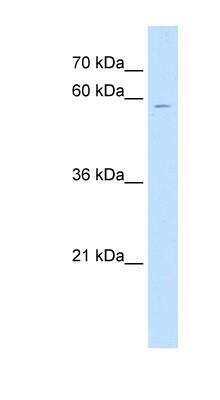 Western Blot: ChGn Antibody [NBP1-59218] - Jurkat cell lysate, concentration 0.2-1 ug/ml.