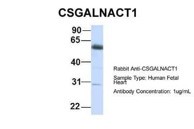 Western Blot: ChGn Antibody [NBP1-59219] - Human Fetal Heart, Antibody Dilution: 1.0 ug/ml.