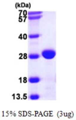 SDS-Page: Recombinant E. coli Chaperone protein FimC Protein [NBP2-22648]