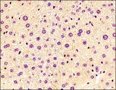 Immunohistochemistry-Paraffin: ChemR23/CMKLR1 Antibody (BZ194) - Azide and BSA Free [NBP2-80667] - IHC-P analysis of a formalin fixed paraffin embedded tissue section of mouse liver using ChemR23/CMKLR1 antibody (clone BZ194) at 1:200 dilution. The antibody generated an expected membrane-cytoplasmic staining in the hepatocytes. Image from the standard