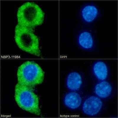 Immunocytochemistry/Immunofluorescence: ChemR23/CMKLR1 Antibody (BZ194) - Chimeric [NBP3-11984] - Immunofluorescence analysis of paraformaldehyde fixed RAW264.7 cells on Shi-fix(TM) coverslips stained with the chimeric rabbit IgG version of BZ194 (NBP3-11984) at 10 ug/ml for 1h followed by Alexa Fluor(R) 488 secondary antibody (2 ug/ml), showing membrane staining. The nuclear stain is DAPI (blue). Panels show from left-right, top-bottom NBP3-11984, DAPI, merged channels and an isotype control. The isotype control was an unknown specificity antibody followed by staining with Alexa Fluor(R) 488 secondary antibody.