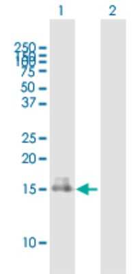 Western Blot: Chemerin Antibody [H00005919-B01P] - Analysis of RARRES2 expression in transfected 293T cell line by RARRES2 polyclonal antibody.  Lane 1: RARRES2 transfected lysate(17.93 KDa). Lane 2: Non-transfected lysate.